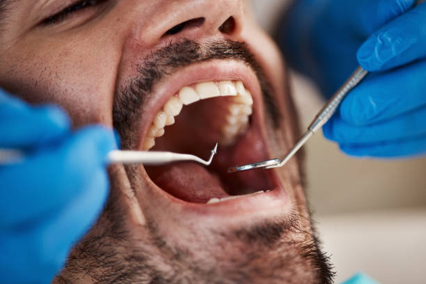 Best Dental X-Rays and Imaging  in Nashwauk, MN